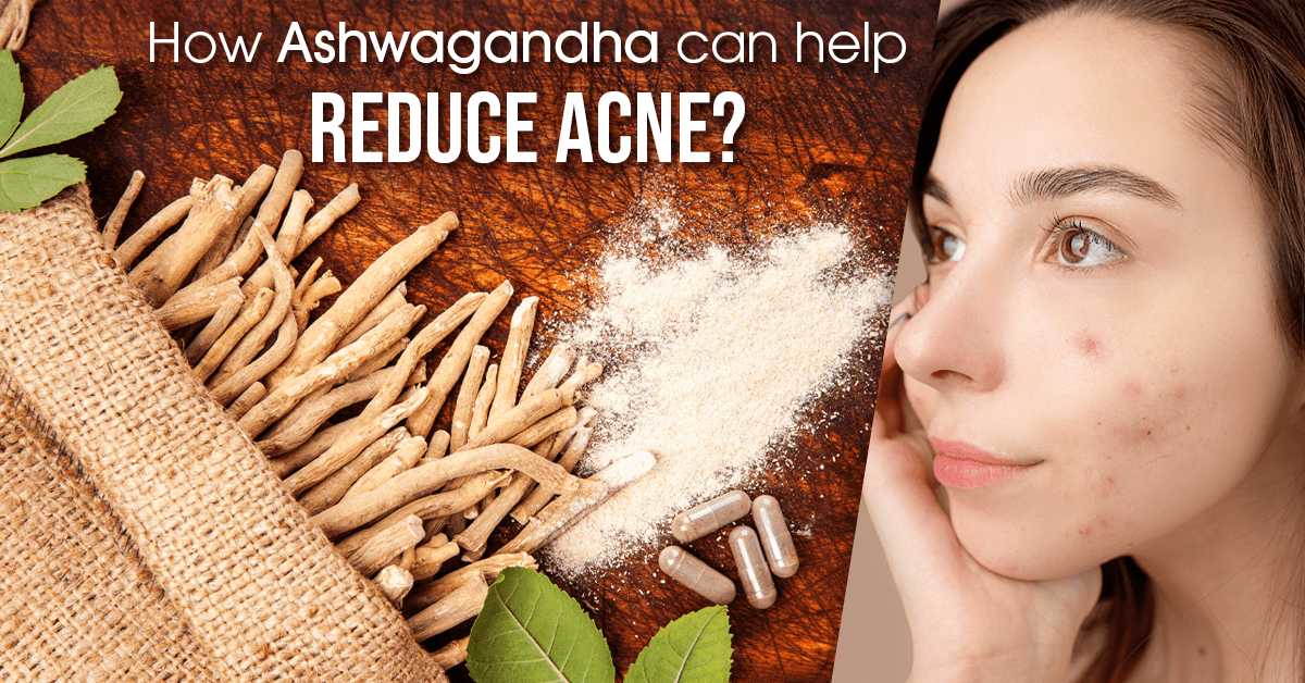 Ancient Herb, Modern Solution: Combating Acne With Ashwagandha