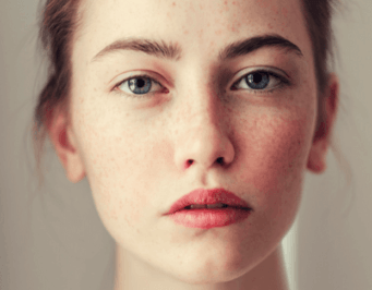 How to Get Glowing Skin with Ayurveda