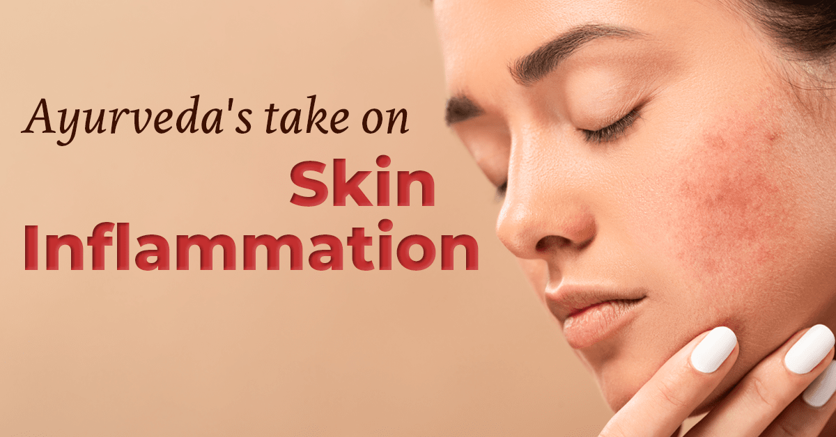 How To Reduce Skin Inflammation The Ayurveda Way