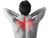 Stiff Neck: Causes And Remedies For Cervical Stiffness