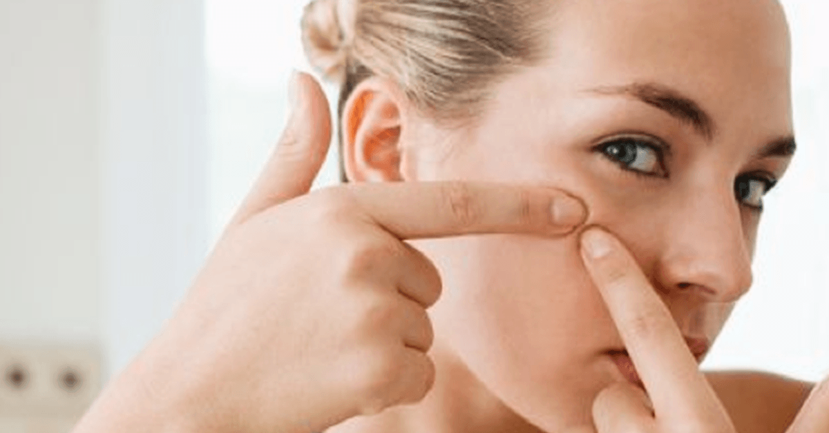 These 10 Things You’re Doing Are Causing Your Skin Problems