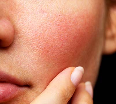 Cuidado facial - Piel sensible