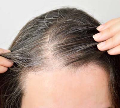 Cuidado del cabello - Cabello sin volumen