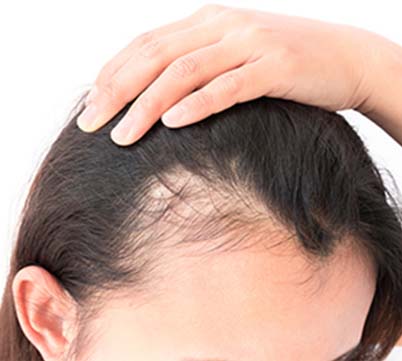 Ayurvedic Products for Thinning Hair