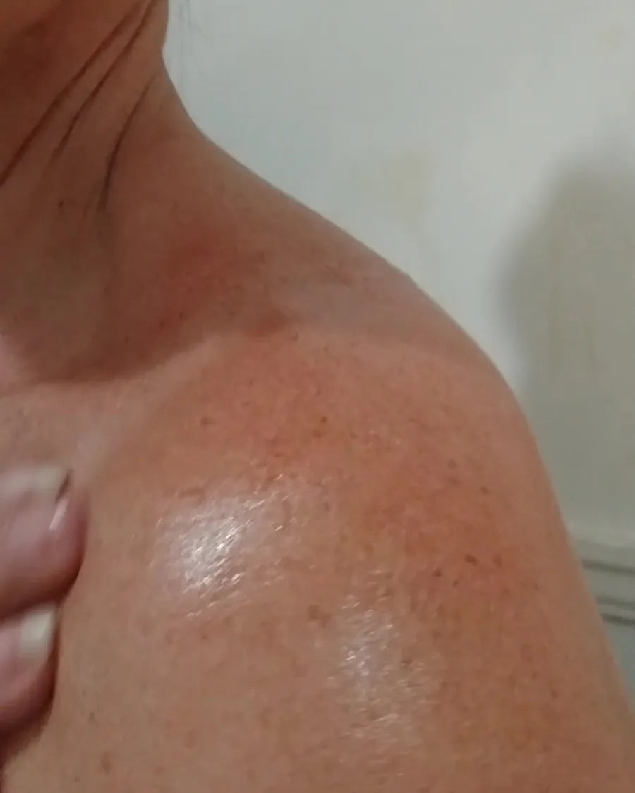 Shoulder and décolleté with oil